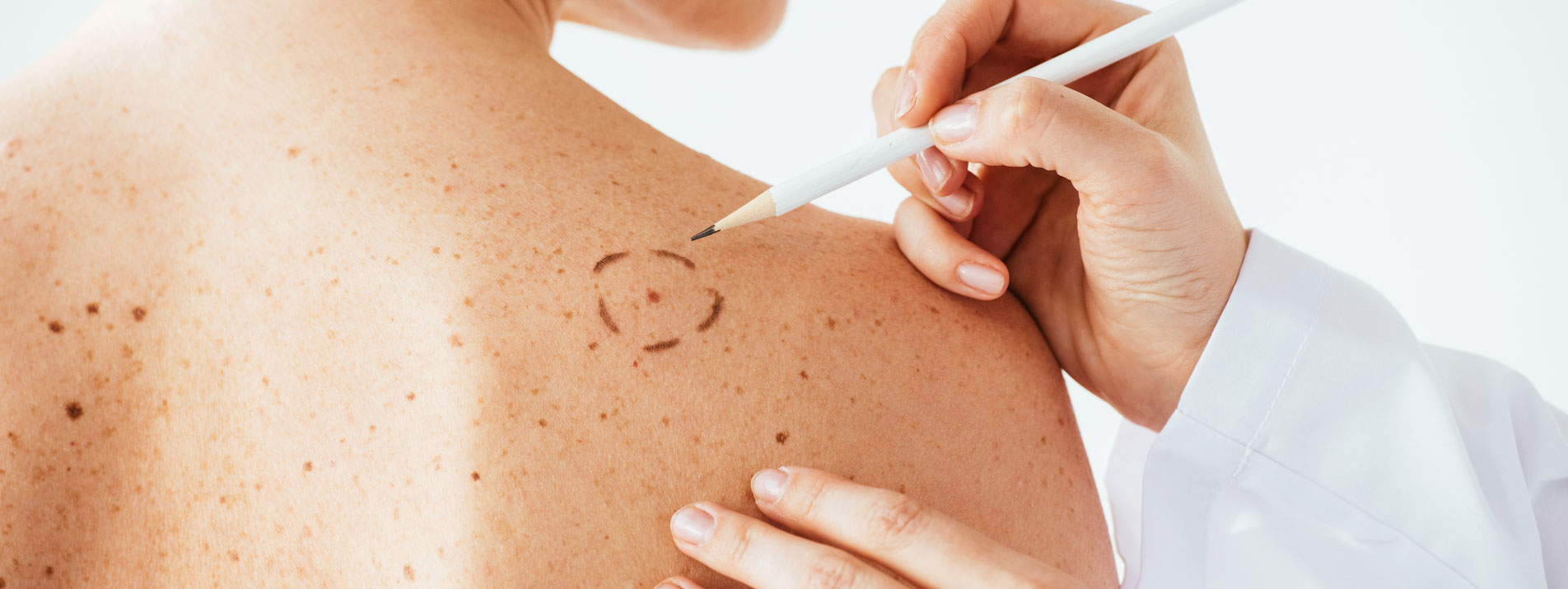 Ambulante Operation in der Dermatologie Hautarzt Dr. Mader & Kollegen in Duisburg-Homberg