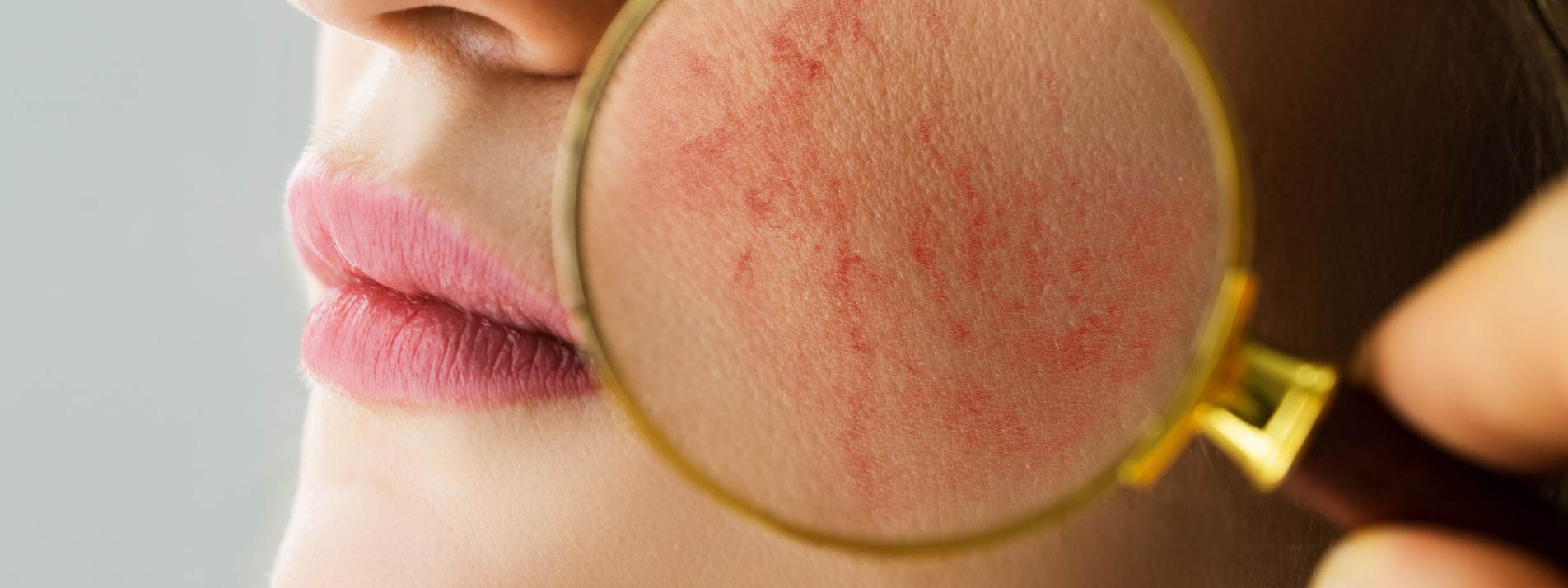MVZ MADERMA GmbH Dermatologische Hautarztpraxis Duisburg-Homberg