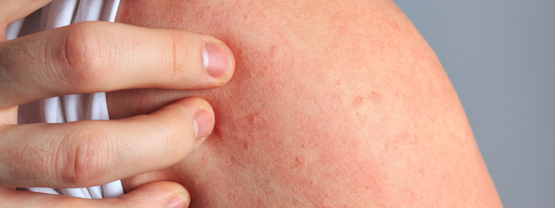 MVZ MADERMA GmbH Dermatologische Hautarztpraxis Duisburg-Homberg