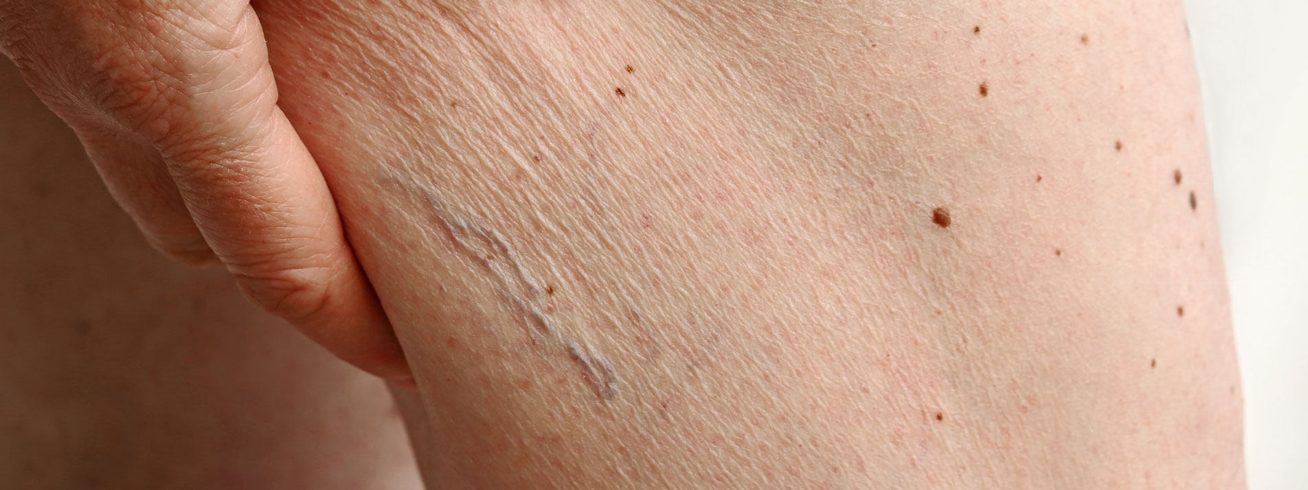 MVZ MADERMA GmbH Dermatologische Hautarztpraxis Duisburg-Homberg